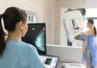 El gobierno bonaerense comenzará a indicar la mamografía a los 40 años